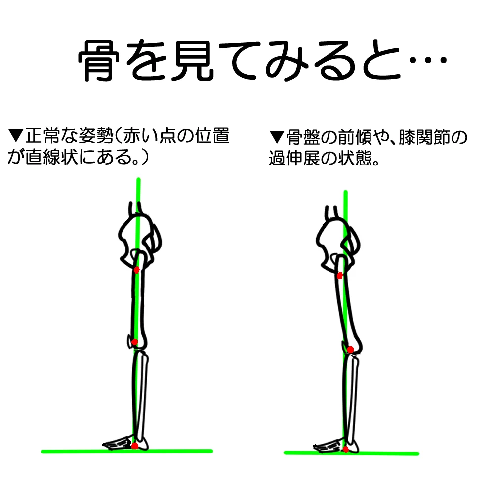 脂肪が原因じゃない！？脚が太くなってしまうのは骨や筋肉が要因かも！