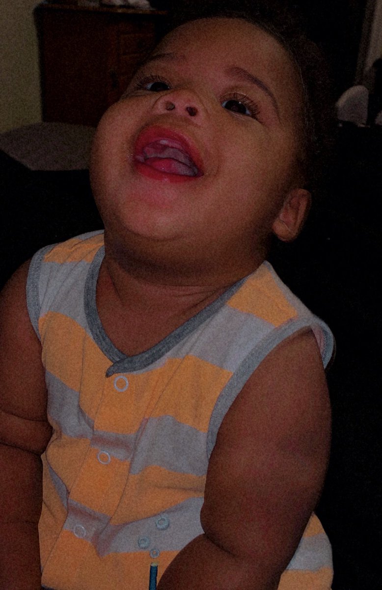 sojuicyjay_'s tweet photo. stop growing son ๐ฅบ
#3rdTooth https://t.co/jNX0ZL4SG3