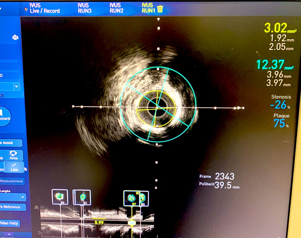 Jose Luis tweet media