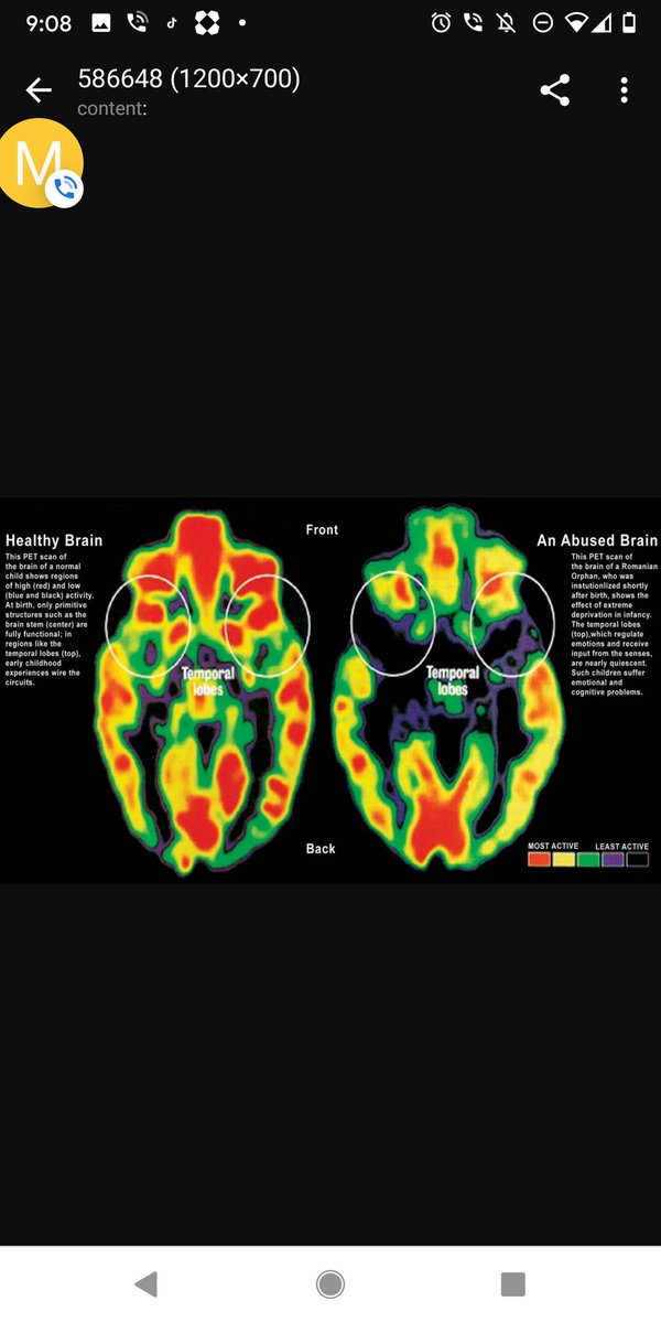 A child's brain architecture changes as a result of trauma. These changes jeopardize children's ability to direct their attention, regulate their emotions and behaviour, and form positive relationships with teachers (Craig, 2006).​Does your pedagogy include trauma informed care?