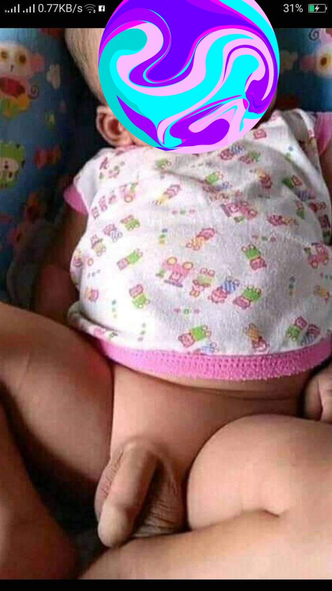 Xtian_Grey19's tweet photo. Bata pa daks na paano pa paglaki? Sana owl.
#AlterPasig #Lasema
#altermandaluyong #Wensha #yamachu #NYSpa #urbanrefugespa #InfinitySpa #hopemed #waterleafspa #amistad #Spada #massagetherapist #legit #mahalta #AlterManila https://t.co/MlE7ssMEA6
