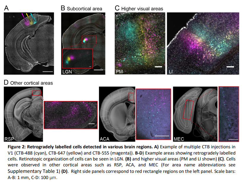 gottapatchemall's tweet photo. Topographic organization of feedback projections to mouse primary visual cortex
https://t.co/wjk0uqPGY6 https://t.co/I70qKuoMxK