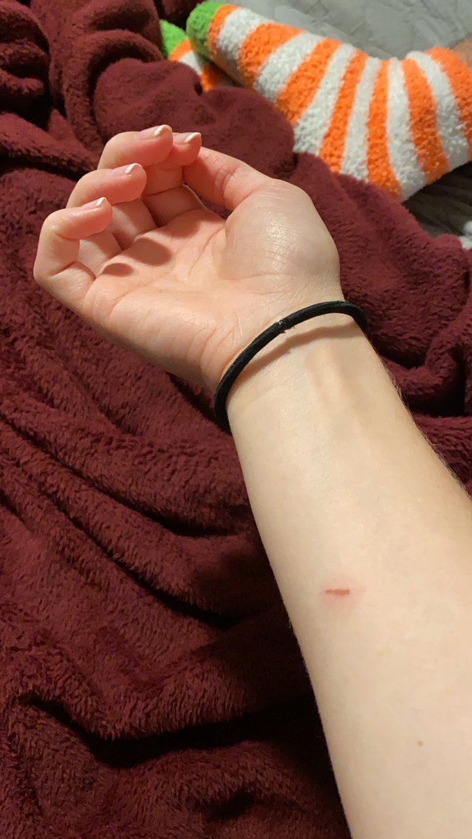erin_eby's tweet photo. Me to Derreck: “I’ve sliced my wrist” https://t.co/opR2QkK4Dl