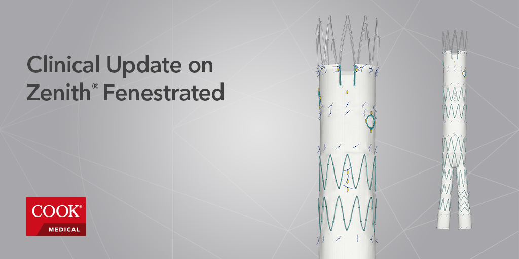 cookvascular's tweet photo. Check out our Zenith Fenestrated AAA Endovascular Graft 5-year data. https://t.co/sms9fGxI5O #ZenithFenestrated #CookVascular #endovascular #graft https://t.co/BTvEA69X98
