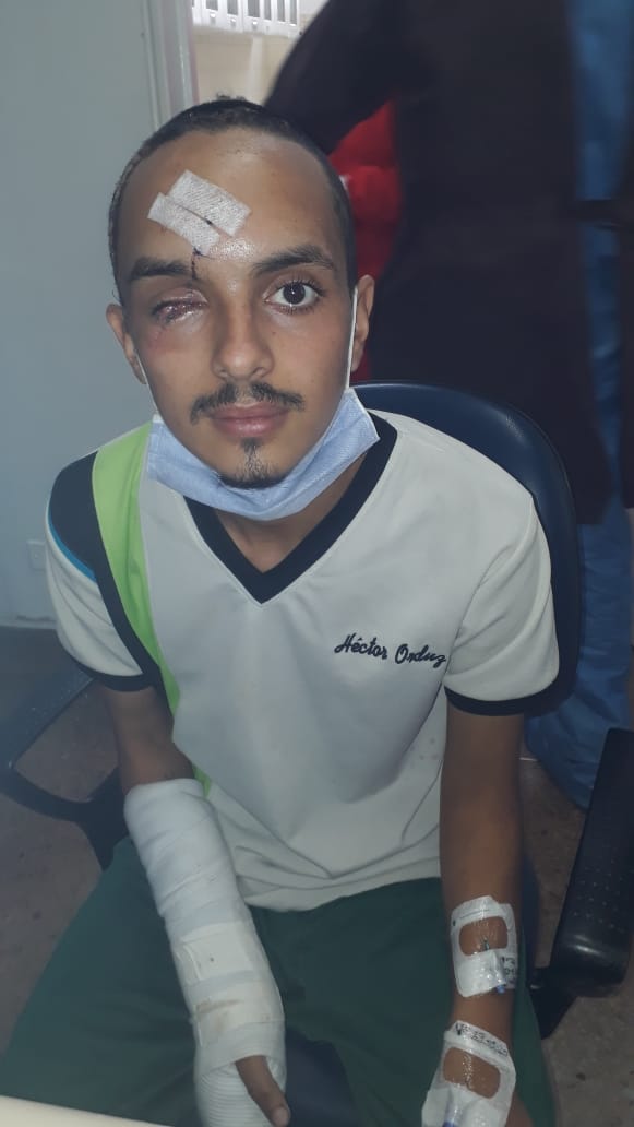 A_aronM_orales's tweet image. Mi nombre es Aarón Morales, fui agredido gravemente por otro grupo de venezolanos mientras regresaba a mi país. Quiero compartirles mi historia...
Ayudame a difundirla! Comparte y etiqueta, mil gracias.
#ServicioPublico #Venezuela #Tachira #Colombia