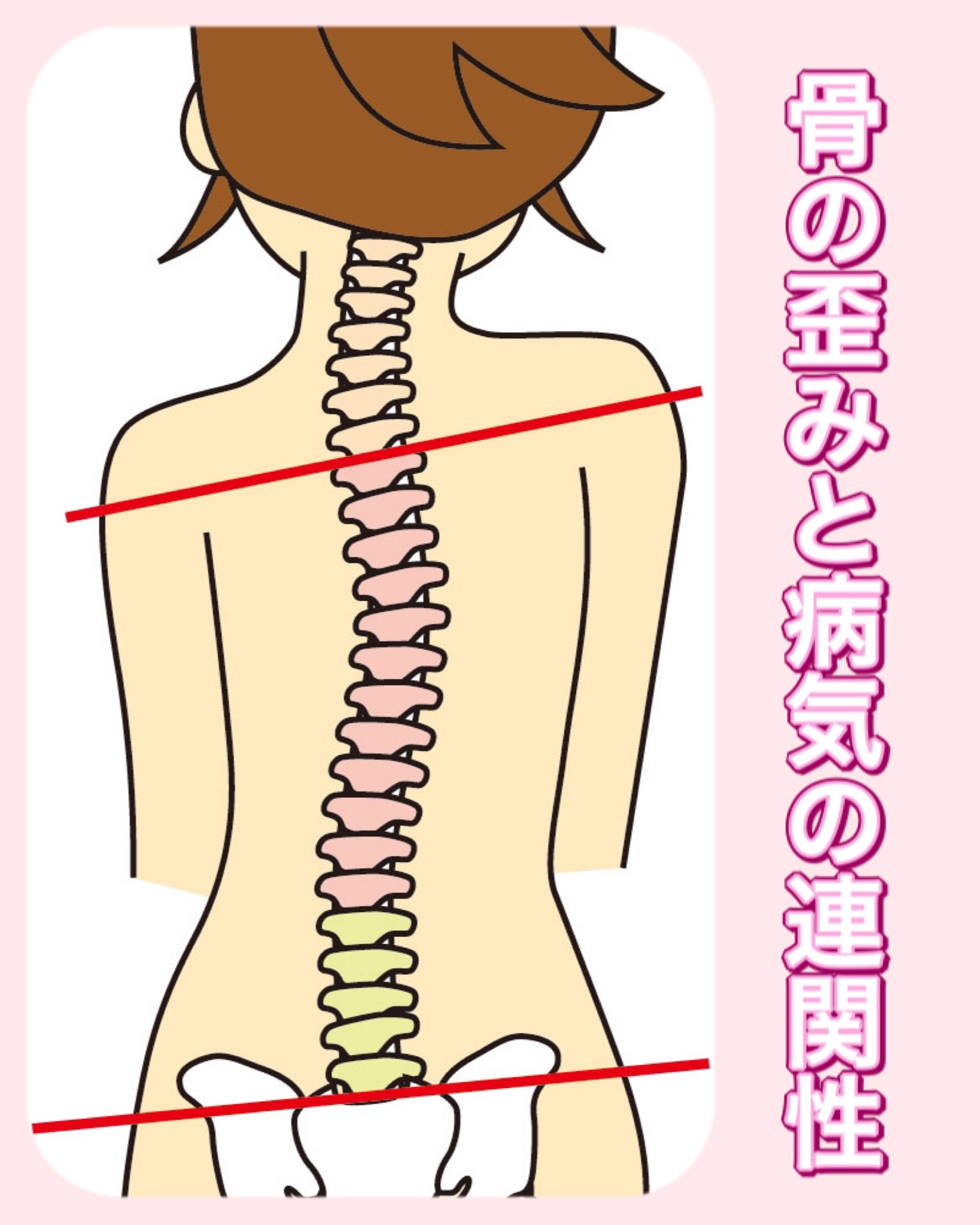 住本 小夜子 メンタルケア心理士 骨と病気の連関性 身体の不調 もしかして 骨の歪みが原因かも T Co Uydctqqqtu くろせ接骨院 東広島 東広島市黒瀬町 メンタルケア心理士 精神解剖生理学基礎 背骨の歪み 自律神経 カイロ