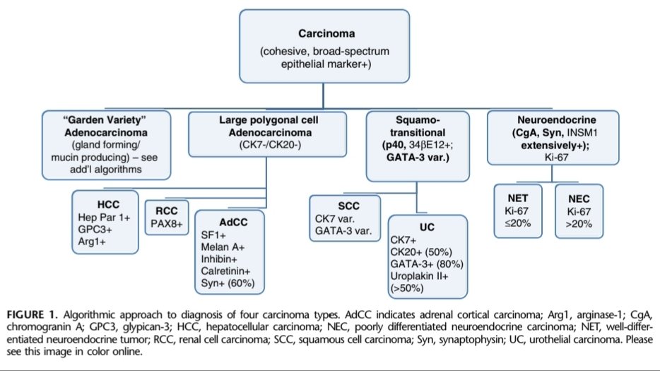 Once determining a carcinoma from the H & E slide and atleast 1 broad spectrum keratin,Confirm a squamotransitional origin by p40, 34BE12, and GATA-3.Though if one were to choose only 1, go with p40- sensitive for BOTH squamous and transitional.(Focus on the third arm )