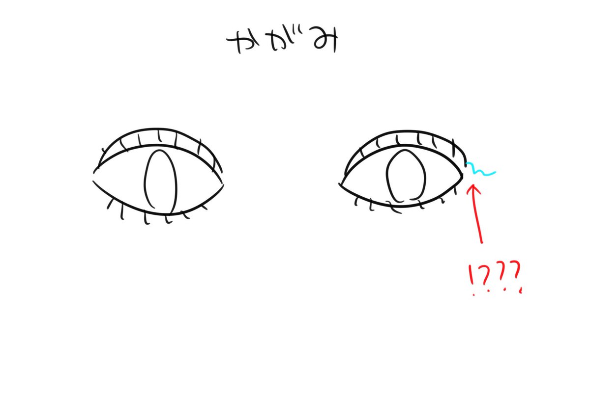 二重から糸でてきた
(手術して今日で10日目) 