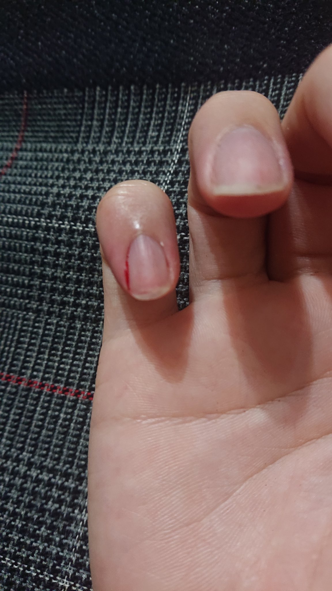 アッキーの趣味部屋 爪のささくれ引っこ抜いたら血が アクアリウムやってると 水槽いじったり土いじるから化膿することあるから嫌なんだよね たまになるけど原因何だろう 爪ささくれ T Co Mlcozfcjp0 Twitter