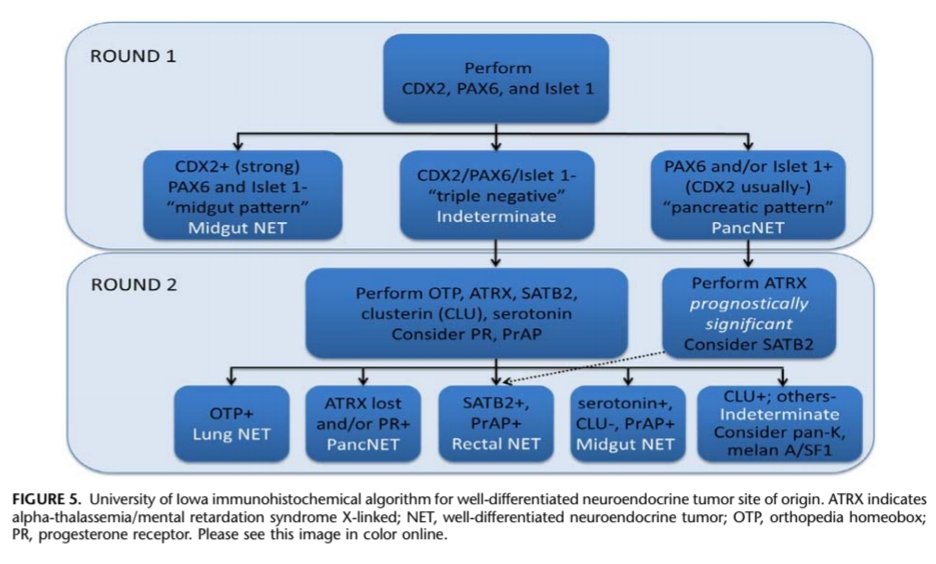 However an ihc algorithm can also be used in determining the primary, especially if imaging and history yields no lesions...This algorithm is based on the fact that most occult primaries are pancreatic or jejunoileal in origin- as these are hard to see in imaging (endoscopy)