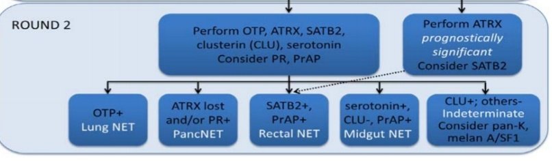 The second round will focus on other possible origins, while not ruling out the possibility of PancNET or midgut NET. OTP+: lungATRX loss and/or PR +ve: pancreasSATB2+, Prostatic Acid Phosphatase (PrAP) +: rectalSerotonin+, clusterin -ve, PrAP+: Midgut