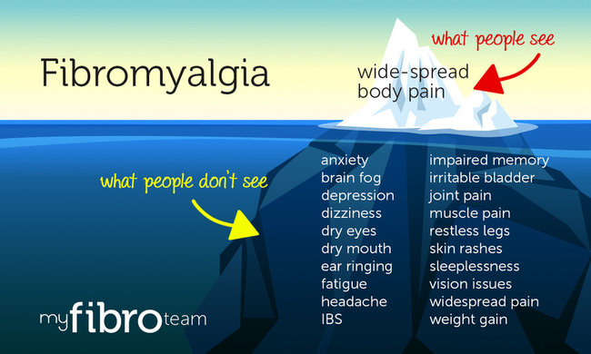 DearFibro's tweet photo. #Fibromyalgia #Invisiblesymptoms #WidespreadPain #BodyPain #PeopleDontSee #Anxiety #BrainFog #DryEyes #DryMouth #Fatigue #Headache #IBS #WeightGain #jointPain #RLS #ImpairedMemory #Depression #Allodynia #Misophonia #HeatSensitivity and many more https://t.co/RIhr3t05qg