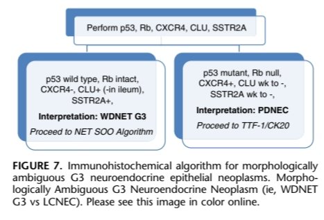 An area of controversy is the differentiation of WDNET G3 and PDNEC. Ki67 cannot be used as a classifier since there is substantial overlap, but p53 mutant and Rb null phenotype would point toward a PDNEC. Clusterin+ (except in WDNET of ileum) and SSTR2A+ point towards WDNET.