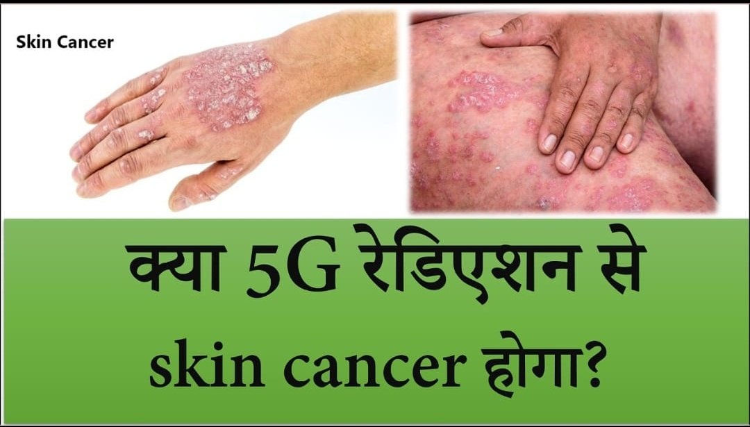 Deepaks8233's tweet photo. https://t.co/d38Fsijm3e
Video link☝️
#jio5g
#5gradiation
#5gspeedtest
#5gindia
#radiation
#fightcancer
#electromagnetic https://t.co/BsGkNVQZ5z