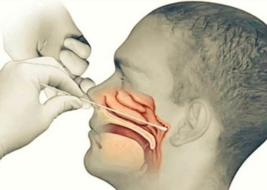 jisanchis's tweet photo. No entiendo como el gobierno no saca  una campaña de concientizacion con esta imagen, le tengo más miedo al hisopado q al virus https://t.co/sIjb4wniPv