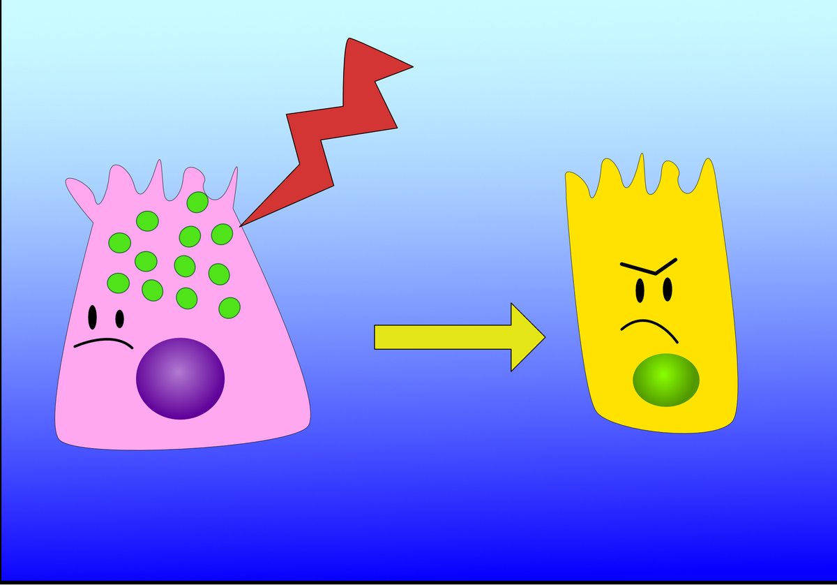 Pancreatic acinar cells change in appearance in response to injury, becoming closer to ductal cells, this is called acinar to ductal metaplasia (ADM). BUT when KRAS mutation happens, ADM may evolve to pancreatic intraepithelial neoplasia (PanIN) and then to PDAC