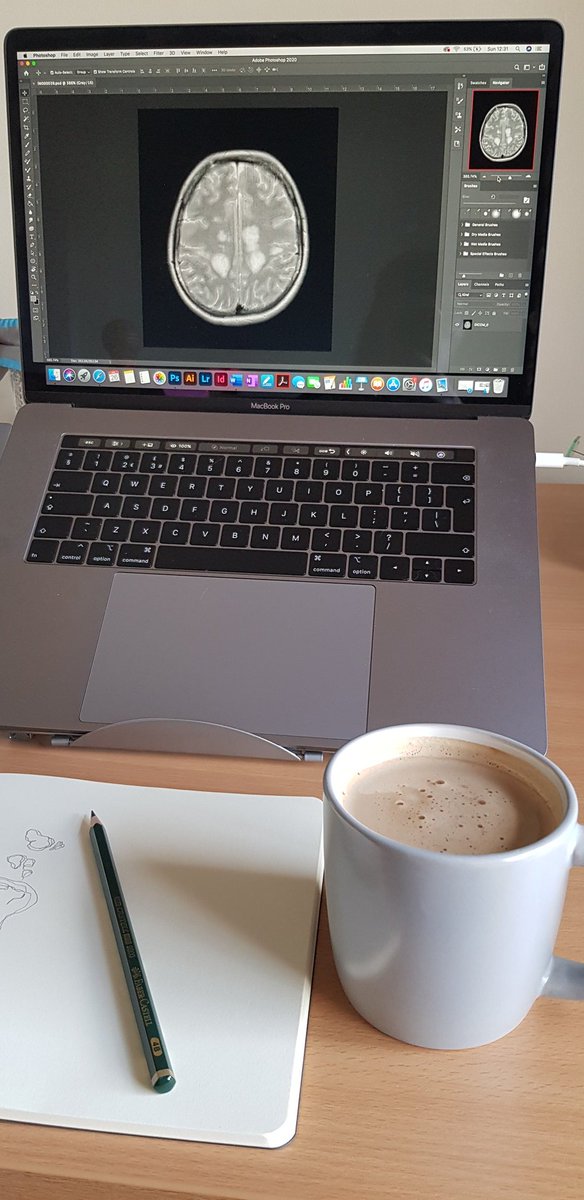 charcotstudio's tweet photo. I'm still trying to figure out my Work/MS Life balance...including my physical balance! So today is a chilled one with coffee & drawing! 🧠💕 #MSlife #selfcare #MS #MultipleSclerosis #ThisisMS #spotthelesions #makingMSvisible #redesigning #MRIscans #MSawareness #stopMS https://t.co/3Mb2WKM7vS