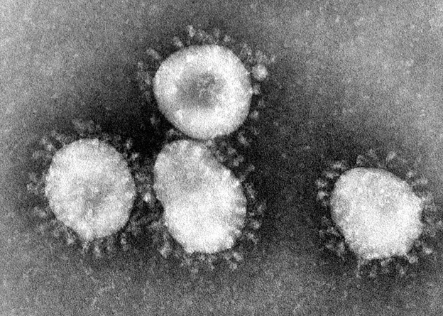 Coronavirus just refers to a virus that has protein spikes on its surface, as this makes it look a bit like a crown when viewed under a microscope. The viruses that caused the SARS and MERS outbreaks were also coronaviruses. And, so are the viruses that cause the common cold.