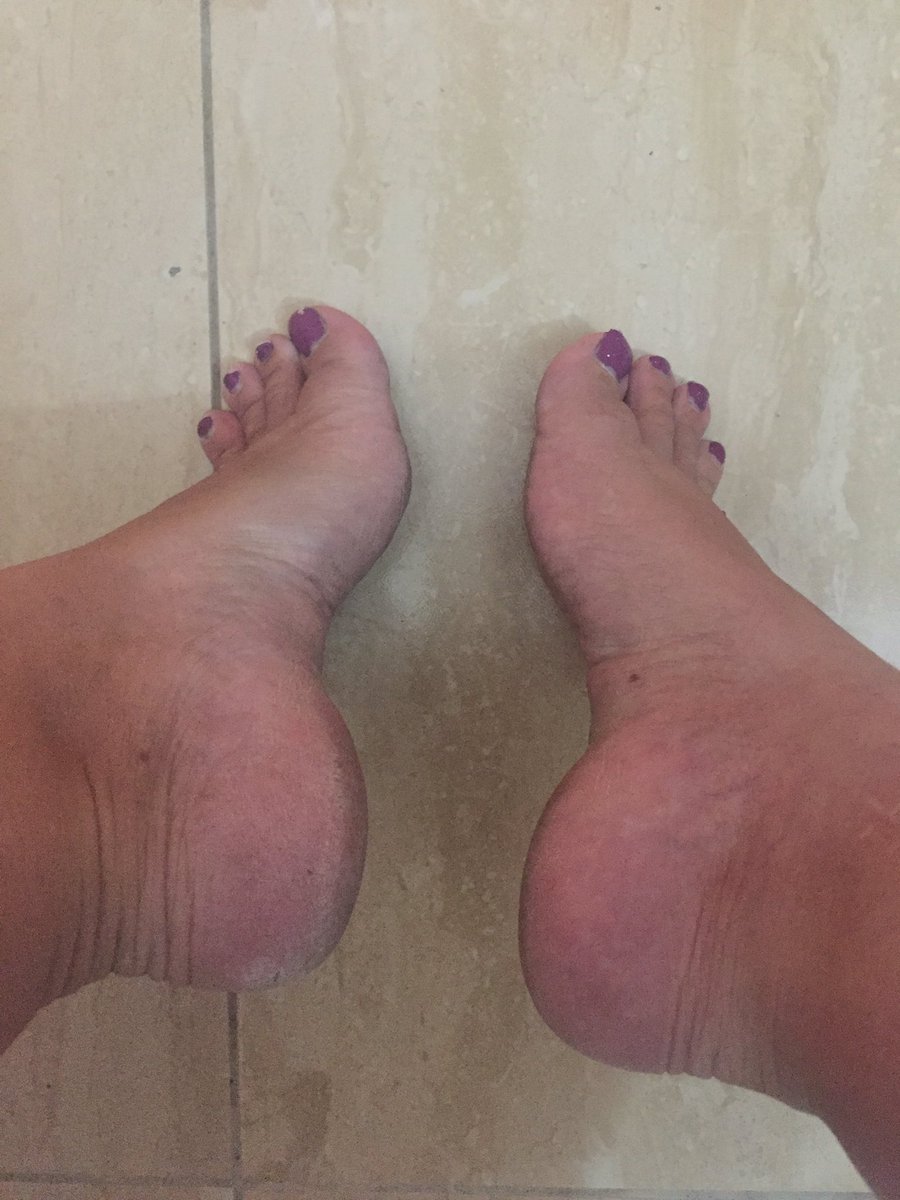 aphrodite_foot's tweet photo. Today it’s all about the arch #femdom #findom #arch #soles #Feetfettish #picsforsale #wallet #paypiggiewanted #drain #humiliation #cyprus #kktc #turkish https://t.co/DKSDl1HTW5