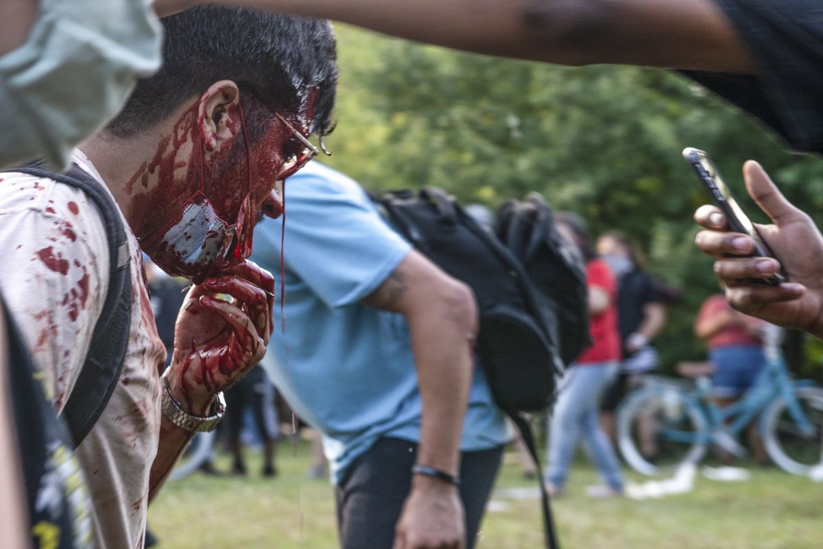 I'm not seeing numbers for how many protesters were injured during the police riot, but at least 20 complaints have been filed with the police accountability office, and judging from gruesome photos in the news, there must have been many serious injuries. https://chicago.suntimes.com/2020/7/20/21331216/columbus-statue-protest-police-vigilantes-grant-park-lightfoot