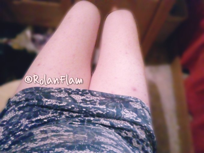 Me compr&eacute; ese vestido de flores por m&iacute; cumplea&ntilde;os, siento que est&aacute; linda &iquest;Qu&eacute; dicen chicos(as)? https://t<a href="/tag/trap"class="tags"><span>#trap</span></a><a href="/tag/crossdresser"class="tags"><span>#crossdresser</span></a><a href="/tag/trapboy"class="tags"><span>#trapboy</span></a>