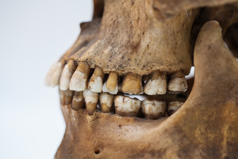 Ancient teeth show history of epidemics - it's all in the DNA tinyurl.com/y2nntqre