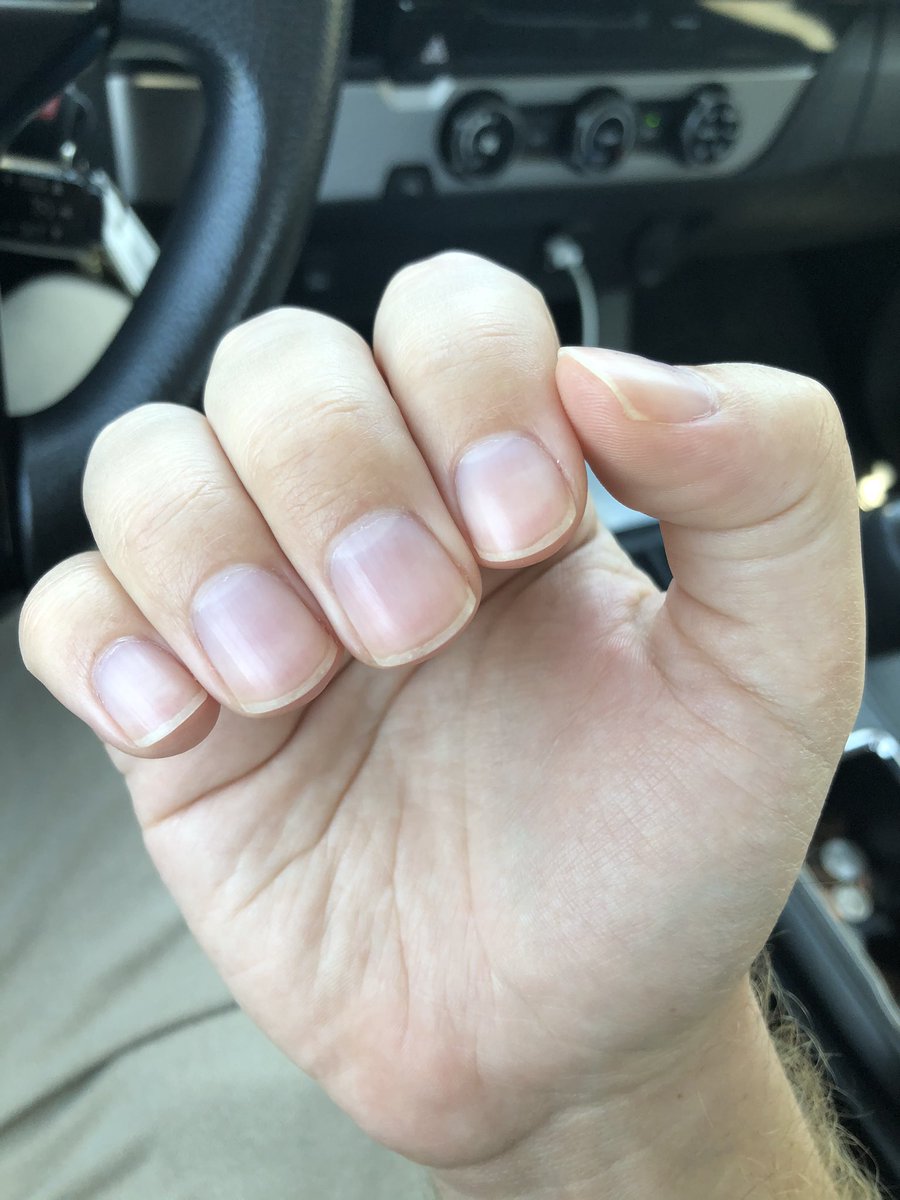 princelyfeet's tweet photo. Perfection #malehands #manhands #boyhands #perfecthands #sexyhands #smoothhands #handmaster #handslave #handdom #handdomination #alpha #alphahands #handworship #worshipme #worshipmyhands #cashmaster #findom #finsub #malenails #nailaesthetic #handaesthetic https://t.co/jAWv0frfsE