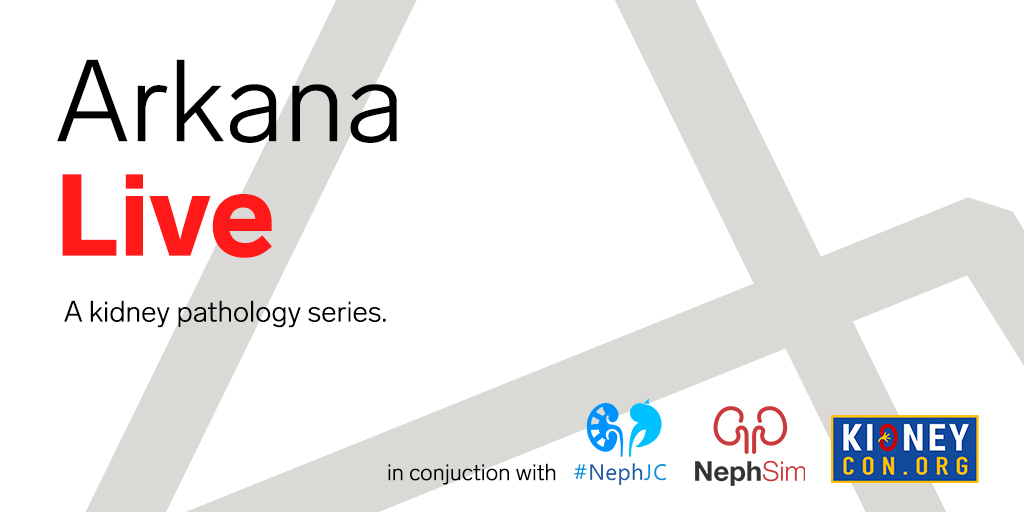 Nephro_Sparks's tweet photo. Join us for the next #ArkanaLive on Saturday, August 8th from 11am-noon EDT.

Topic: FSGS

co-moderated by @ssfarouk 

in conjunction with @Neph_SIM @NephJC @KIDNEYcon 

Register here: https://t.co/zt0cjEiz4H

View past sessions here: https://t.co/CbUFrNL23A

#kidneypath #FOAMed https://t.co/raUq5pT2ZD