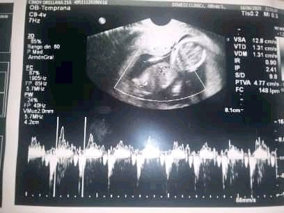 cindywazowski's tweet photo. Es tan lindo tenerte en mi vientre, mamá te ama mi pequeño bebé 💜 https://t.co/p3sW5ih7MX