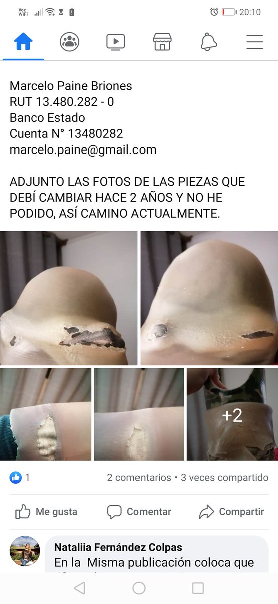 Cathyta_29's tweet photo. @leonardofarkas el es un amigo que necesita ayuda la está pasando muy mal y de verdad necesita una pierna para poder tener una vida de calidad, si lo puedes ayudar aunque sea con un numerito de rifa me soy por pagada, se que usted es generoso, por favor ayudelo.. https://t.co/ufFl4lzExf