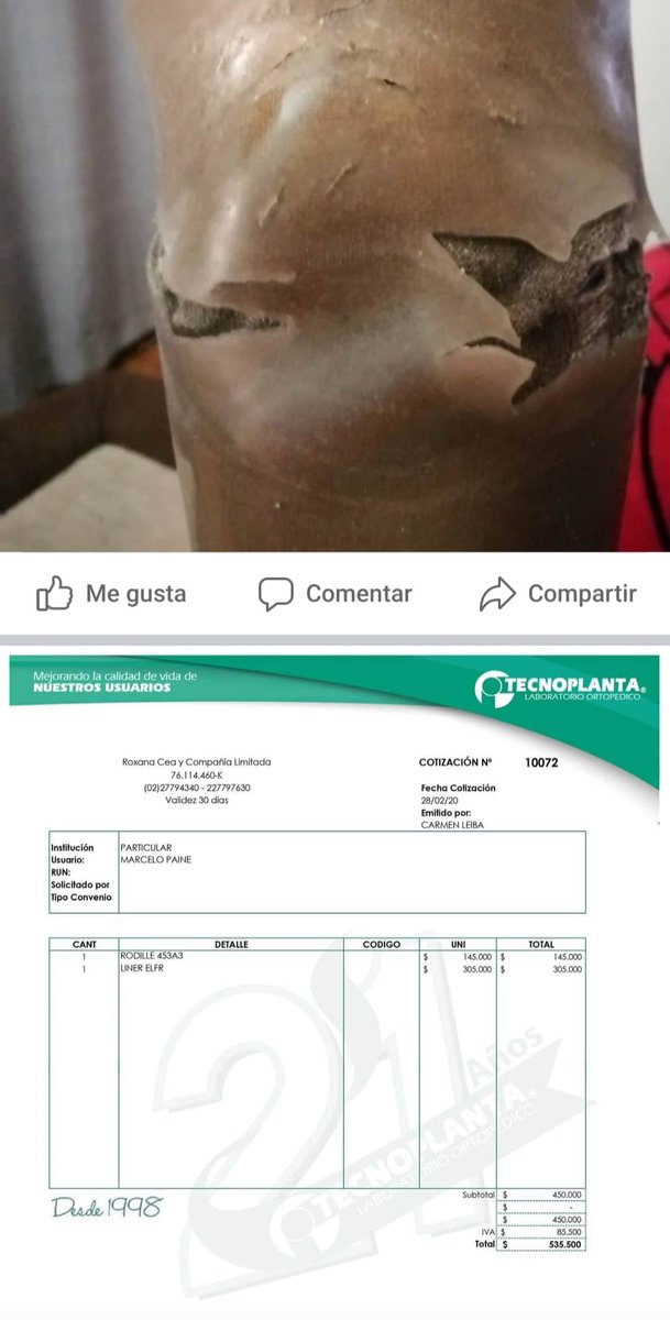 Cathyta_29's tweet photo. @ramirez_polo Buenas noches don Polo, necesito difundir la rifa de un amigo que necesita con urgencia comprar su prótesis para la pierna y poder tener un pasar mas digno y el cual lleva 11 meses cesante... Solo necesitamos difundir para poder ayudarlo https://t.co/tS7HslGlAJ