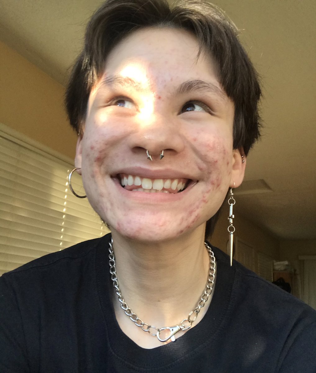 ianaIexander's tweet photo. normalize normal skin!!
🙇🏻‍♂️
i used to be so afraid of how my hormonal acne would affect my ability to get acting roles, well i can tell u from experience it’s worth it to embrace ur true self. anyone that makes u feel ashamed of ur body for ANY reason doesn’t deserve ur time!! 💥 https://t.co/NNcpm2IlWA