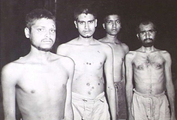 7/9: These unidentified soldiers were victims of spirochetal disease, and diptheria. For almost four years the POWs had received no, or at best rudimentary, health care. They had had no access to antibiotics, penicillin, etc. All survivors were malnourished; skin diseases, etc