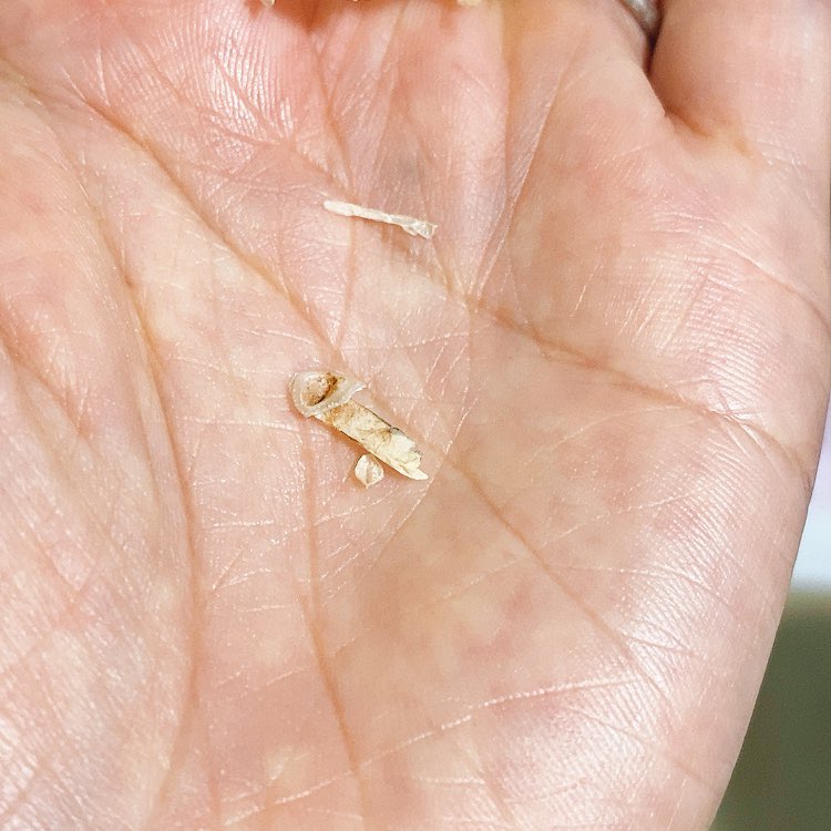 源 原稿中 フトアゴの鼻から2本しか収穫できない 鼻えのき 脱皮した鼻の穴と鼻内部の皮がえのきのようにニュルッと取れる 顔面皮塗れだけどまた男前に剥けましたね フトアゴのだてまき