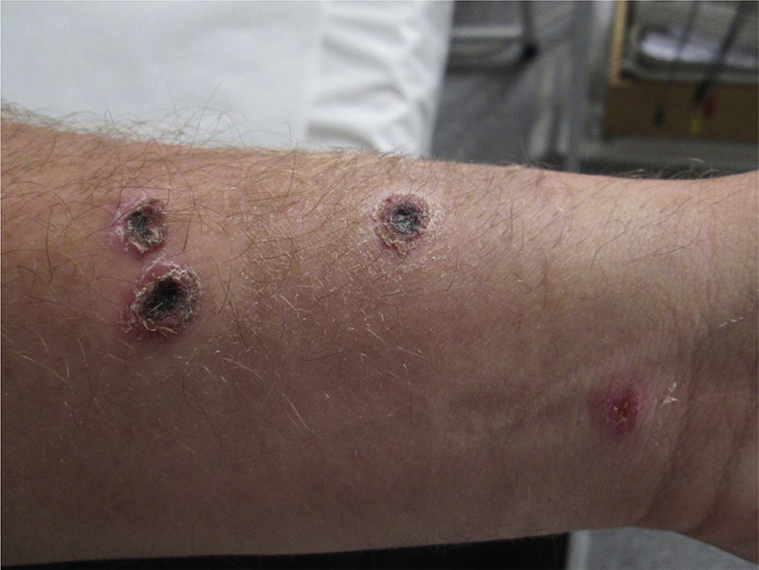 IDN_Doctors's tweet photo. #IDN_MedicalPost📬

Wuhan lab creating anthrax-like pathogens in Pakistan: Report.
 
For more such Medical Cases and Posts, Download the app👉https://t.co/mj8sOPZoSY 👨‍⚕️👩‍⚕️

#DoctorsApp #AppForDoctors #IndianDoctorsNetwork #DoctorsNetwork #Doctors #ProfessionalNetwork #IDN https://t.co/wsWtnL3WoJ