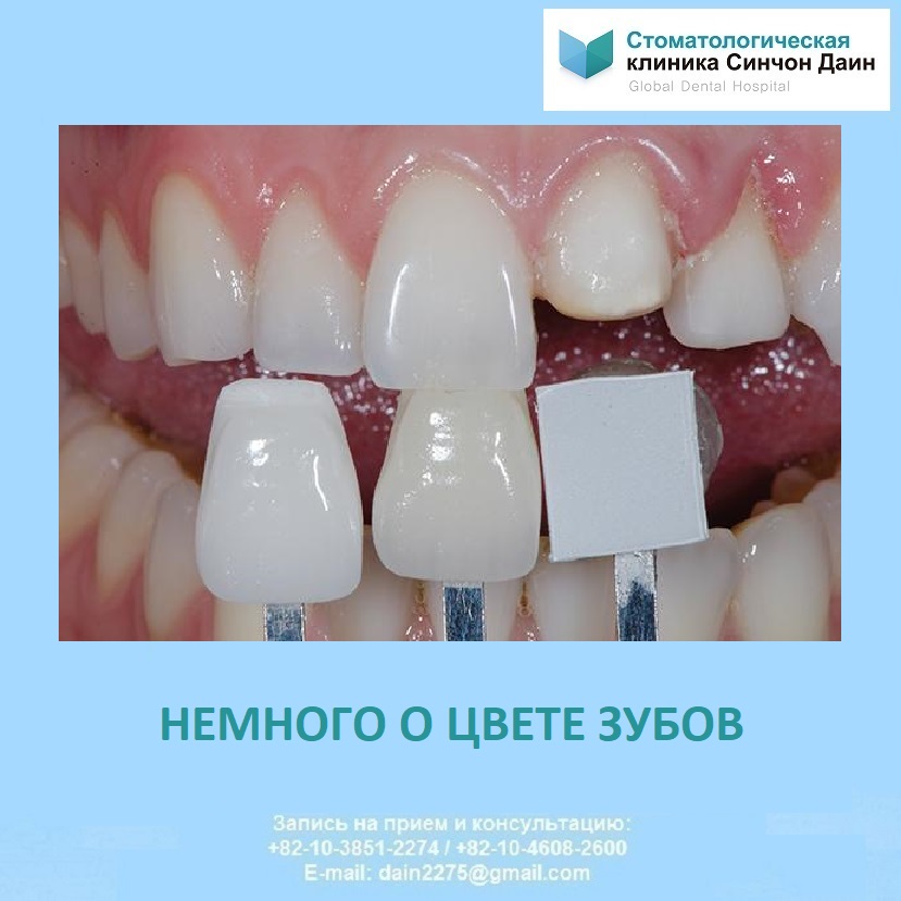 MariaDain's tweet photo. Оттенки зубов разбиты на 4 группы:A(красновато-коричневый)B(красновато-��елтые)C(серые оттенки)D(красновато-серые оттенки)Внутри каждой группы выделяется несколько степеней насыщенности–от 1 до 4.Стоматолог легко определит цвет Ваш��х зубов,прикладывая к ним образцы шкалы Вита https://t.co/G4kABf4vof