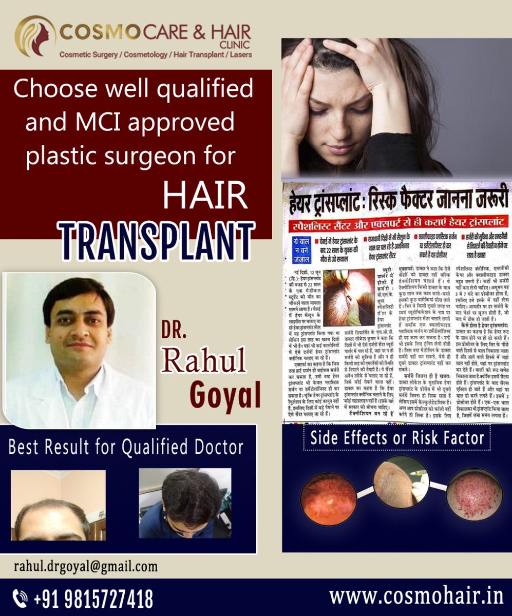 31  Chandigarh Hair Transplantation