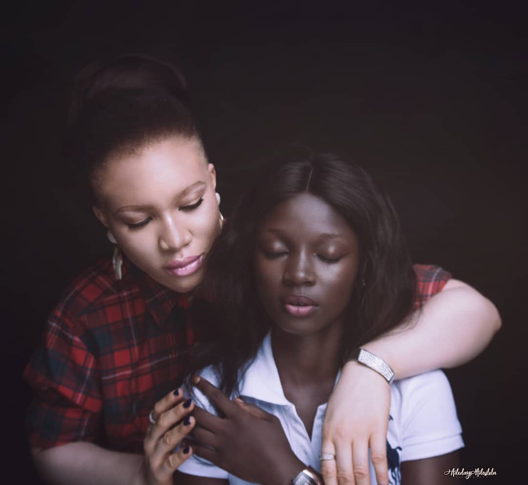 OAMFoundation's tweet photo. Ebony x Ivory
#BeyondTheComplexion #AlbinismAwareness #Albinism #inmyskiniwin https://t.co/V0EkeLaz89