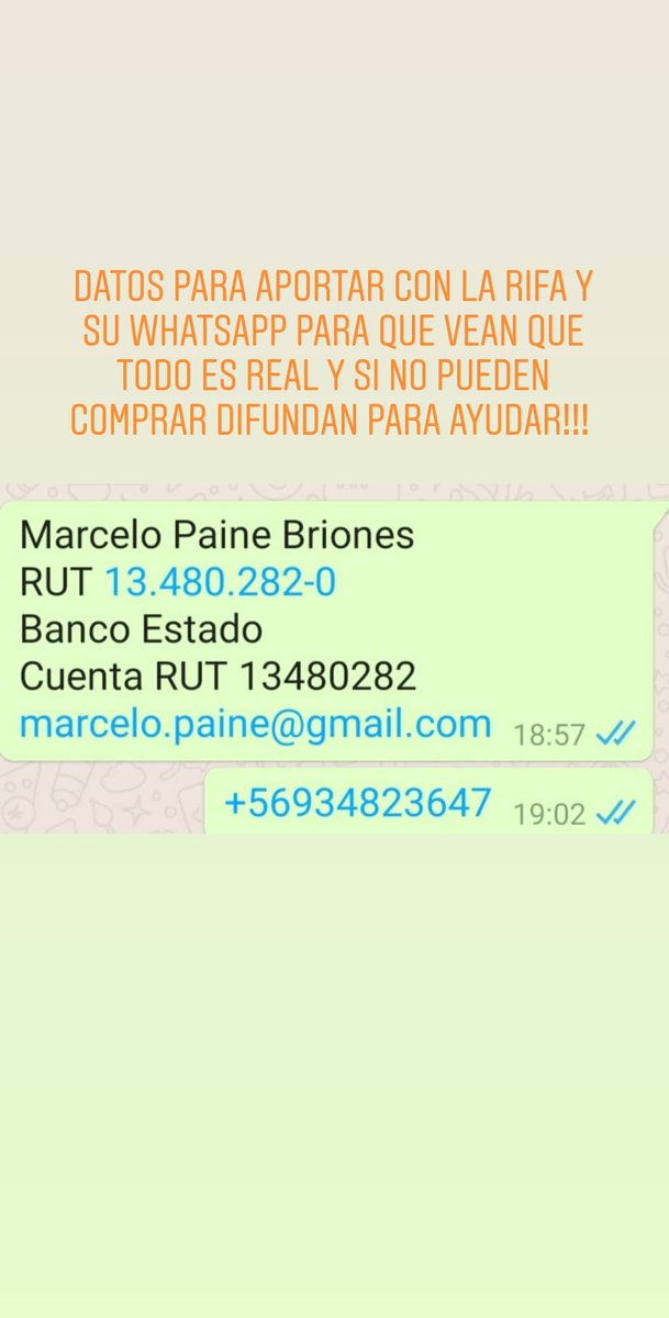 Cathyta_29's tweet photo. @GiorgioJackson SE QUE ESTAMOS EN TIEMPOS DIFÍCILES, PERO APAELO AL 💗 DE LAS PERSONAS PARA AYUDAR A MI AMIGO NECESITA JUNTAR EL DINERO PARA PODER COMPRAR SU PIERNA ORTOPÉDICA Y TENER UNA MEJOR CALIDAD DE VIDA YA QUE EN ESTE PAÍS SI NO CISTEAS TUS INSUMOS JODISTE. AYUDEMOS 🙏🙏🙏 https://t.co/RJBAqPBoXo