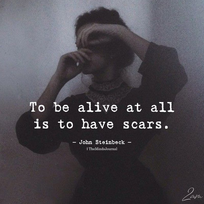 TheMindsJournal's tweet photo. To Be Alive At All
#alive #inspirationalquotes #lifequotes #scars #themindsjournal #mindtalk #letthemindtalkbegin https://t.co/HERNik6AMd