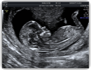 OptionsRightNow's tweet image. Ultrasound Models Wanted! conta.cc/3ftDDyv