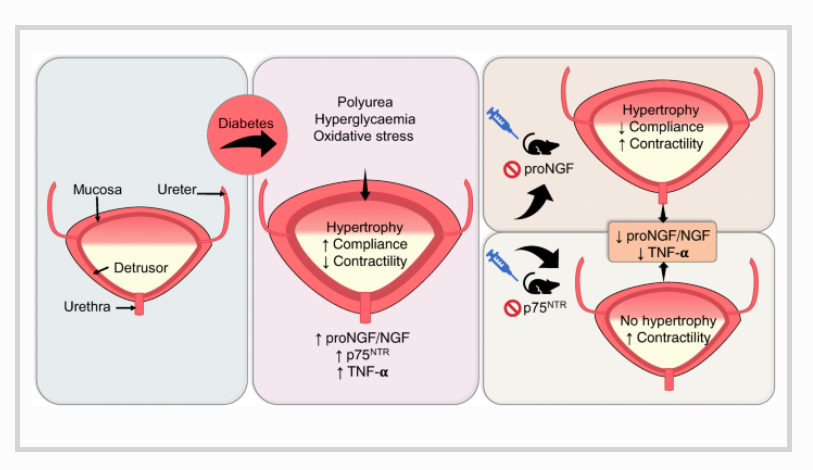 DiabetologiaJnl's tweet photo. Antagonism of proNGF or its receptor p75NTR reverses remodelling and improves bladder function in a mouse model of diabetic voiding dysfunction with reduced TNF-α bladder levels @80_bkr @LysCampeauMD #diabetic_voiding_dysfunction #proNGF #p75NTR https://t.co/DqxjDWDt1B https://t.co/DBhtakTNGd