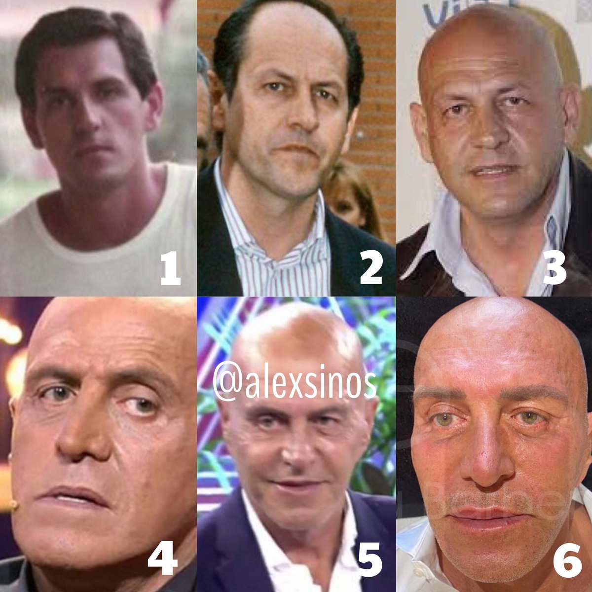 alexsinos's tweet photo. ¿Qué Kiko Matamoros eres hoy? https://t.co/vcqJ6yzqLc