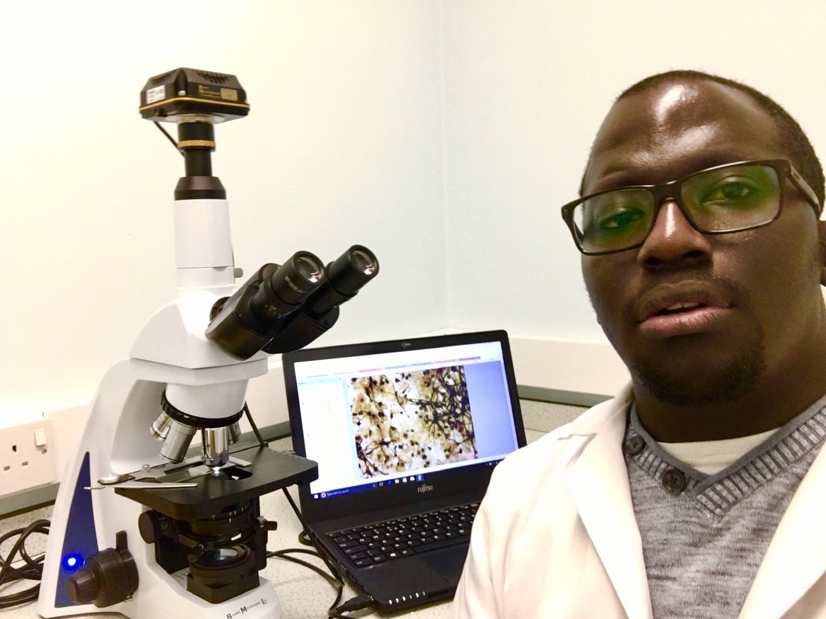 BrianTangara's tweet photo. I am Kenyan 🇰🇪Specialised in Neural Stem Cells in Brain 🧠 Regeneration. BSc Neuroscience (First Class)&amp; MSc Clinical Drug Development (Dist)🇬🇧. Currently looking at Stem Cell therapy as an alternative treatment to SCI in addressing pharmacological failure #BlackNeuroRollCall https://t.co/wTIN2EIqTZ