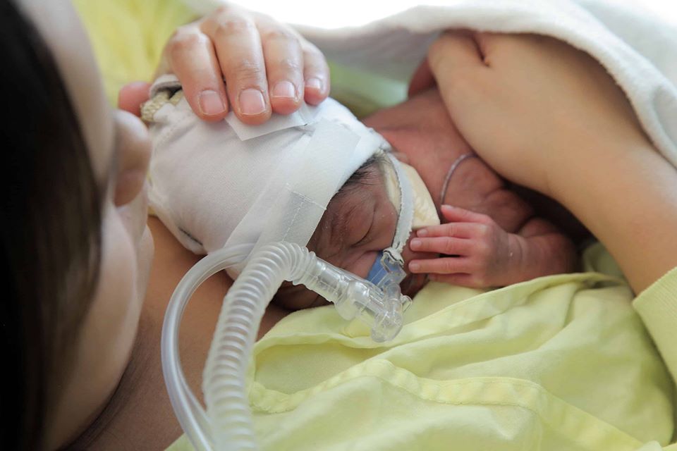 NICU_Musings's tweet photo. Kangaroo care for at least 6 hours a day can improve weight, length and head circumference growth. Effect on weight gain requires at least 2 hours a day and has a dose response.
https://t.co/WDmfRiOyNy https://t.co/moyKZKghX1
