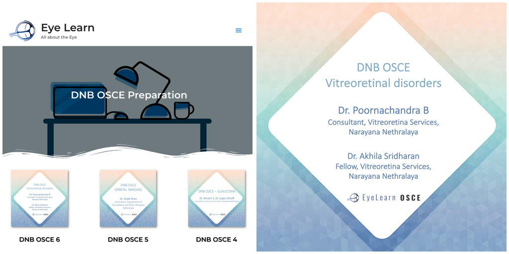EyeLearn_in's tweet photo. Checkout the new DNB OSCE! https://t.co/eHEBhMjCo8

Grateful to Dr. Poornachandra B sir and Dr. Akhila Sridharan (Department of Vitreoretina, Narayana Nethralaya).

FB - https://t.co/g7gwDtLef6
Insta - https://t.co/5tuo4vFJu8

#eyelearn #DNB #ophthalmology #OSCE #vitreoretina https://t.co/Y6msvUToxR