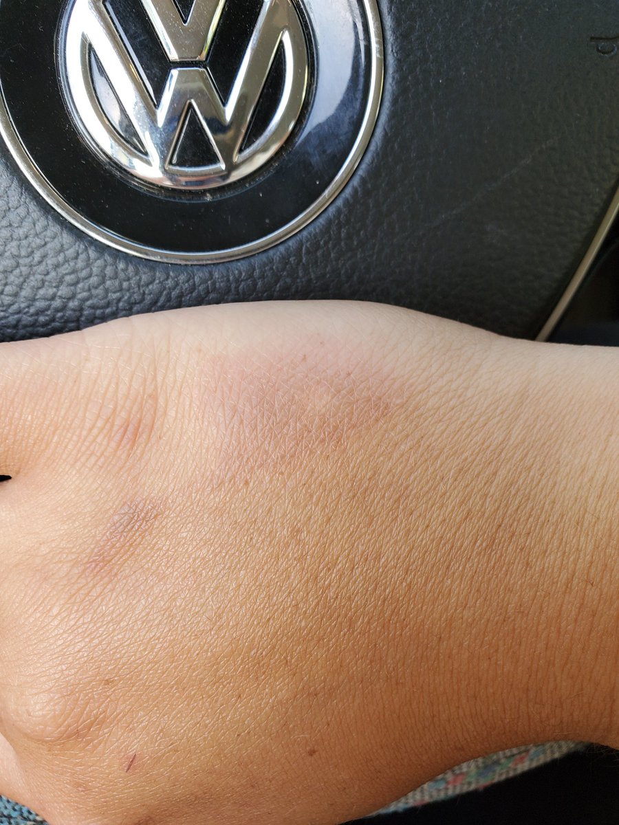 Esmerelda tweet media