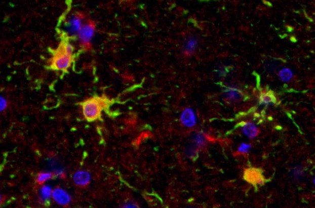 (4/7)We looked in human tissue and this astrocyte response happens in all ALS patients, including sporadic patients, so the mutations themselves aren't the reason astrocytes become reactive. To look at this further, we went back to the mouse model...