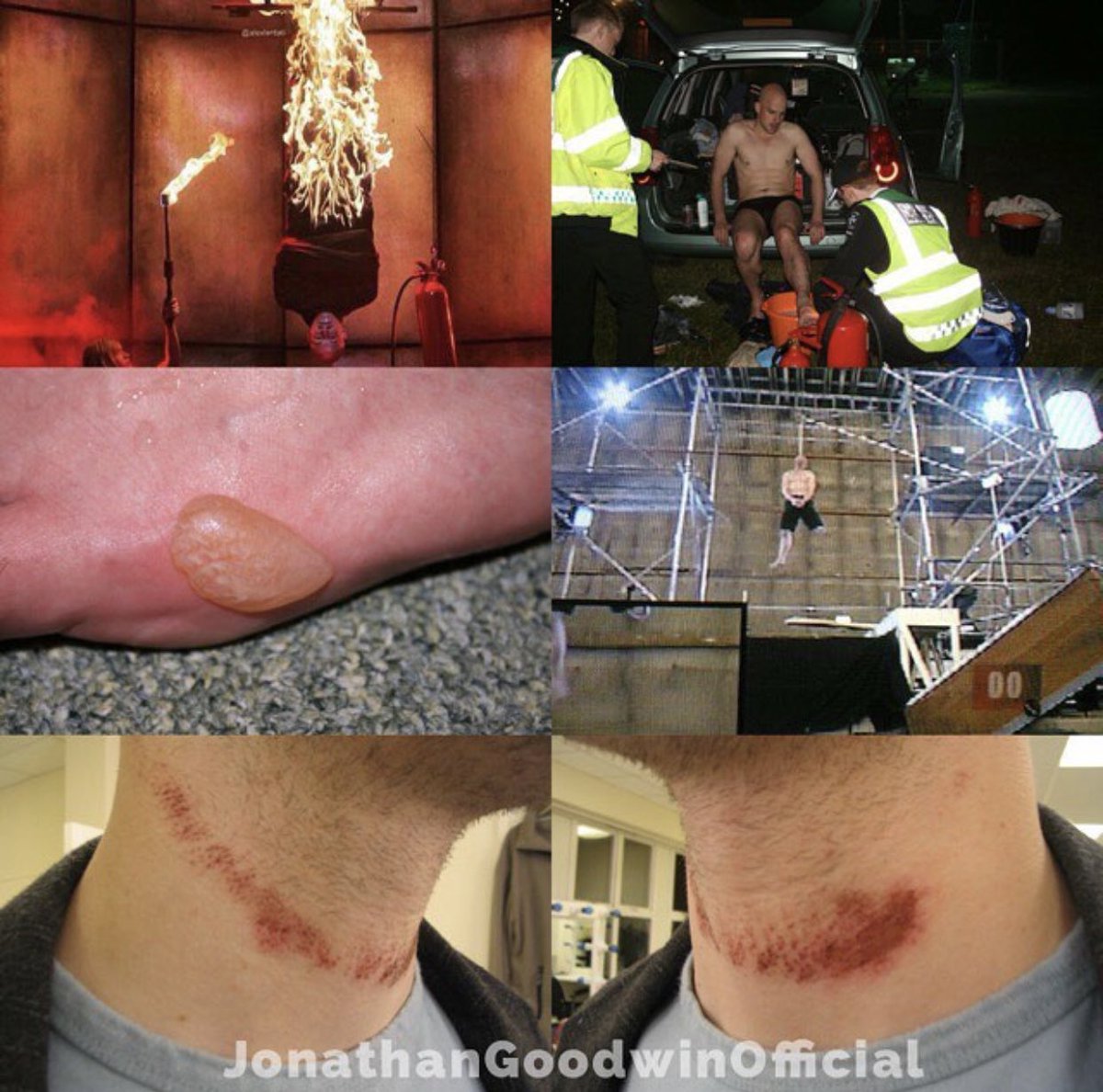 TheDaredevil's tweet photo. The metalwork in my leg and scars on my body say otherwise. But thanks for playing. #TheDaredevil https://t.co/meWSmh8xAI
