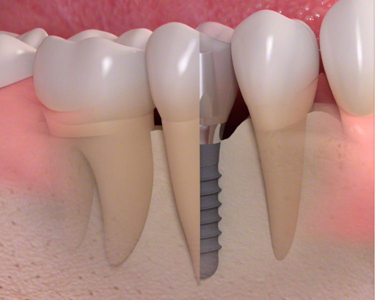 SandstoneDental's tweet photo. We want you to feel proud of your smile! Check out our latest blog https://t.co/svRAIrB5QI
#Dentist #Heswall https://t.co/q0c8FuJcGP